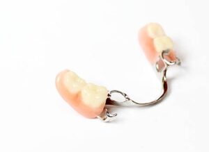 dental-restoration(4)